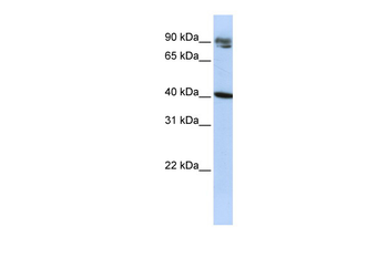 KLHDC8A Rabbit Polyclonal Antibody