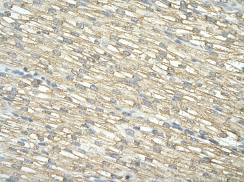 IMP3 Rabbit Polyclonal Antibody