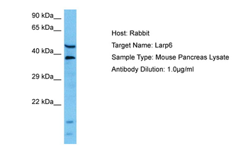 LARP6 Rabbit Polyclonal Antibody