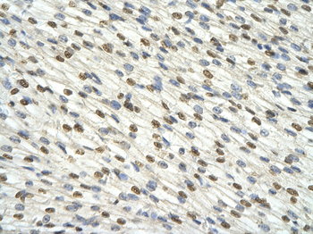 DAZAP1 Rabbit Polyclonal Antibody