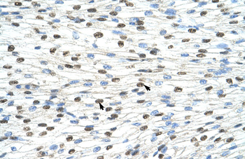 DAZAP1 Rabbit Polyclonal Antibody