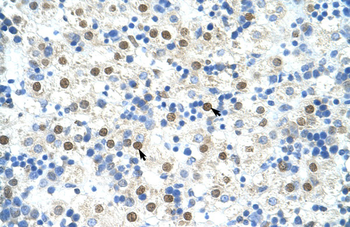 DAZAP1 Rabbit Polyclonal Antibody