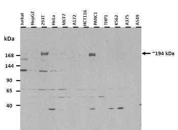 XRN1 Rabbit Polyclonal Antibody