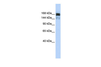 XRN1 Rabbit Polyclonal Antibody