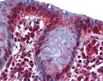 RBM47 Rabbit Polyclonal Antibody