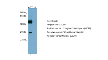 EXOSC4 Rabbit Polyclonal Antibody