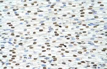 EXOSC4 Rabbit Polyclonal Antibody