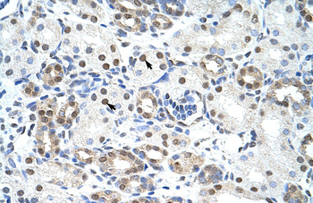 LSM2 Rabbit Polyclonal Antibody