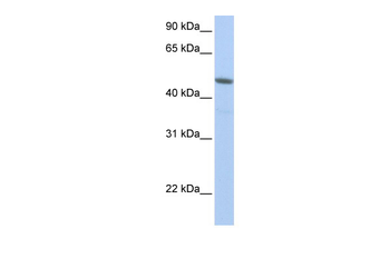 NXF3 Rabbit Polyclonal Antibody