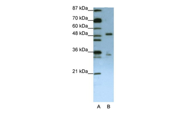 UPF3B Rabbit Polyclonal Antibody