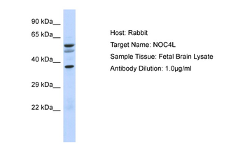 NOC4L Rabbit Polyclonal Antibody