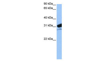 MRPL24 Rabbit Polyclonal Antibody
