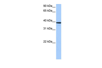 MRM1 Rabbit Polyclonal Antibody