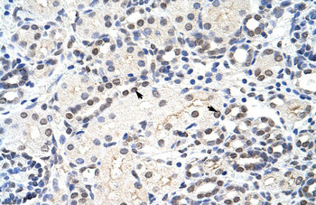MRM1 Rabbit Polyclonal Antibody