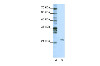 MRM1 Rabbit Polyclonal Antibody