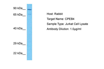 CPEB4 Rabbit Polyclonal Antibody