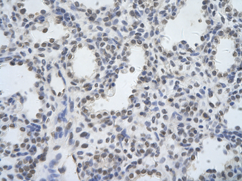 DDX17 Rabbit Polyclonal Antibody