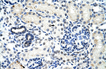 DDX17 Rabbit Polyclonal Antibody