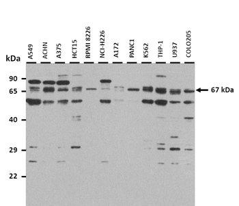 FIP1L1 Rabbit Polyclonal Antibody