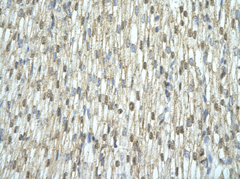 C14ORF156 Rabbit Polyclonal Antibody