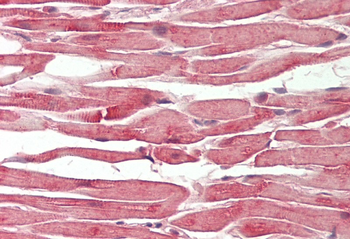 C14ORF156 Rabbit Polyclonal Antibody