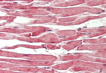 C14ORF156 Rabbit Polyclonal Antibody
