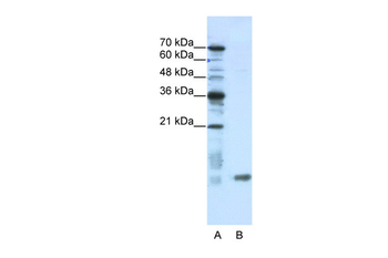 C14ORF156 Rabbit Polyclonal Antibody