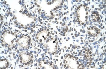 HNRPAB Rabbit Polyclonal Antibody