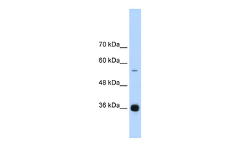 HNRPAB Rabbit Polyclonal Antibody