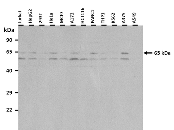 EIF2A Rabbit Polyclonal Antibody