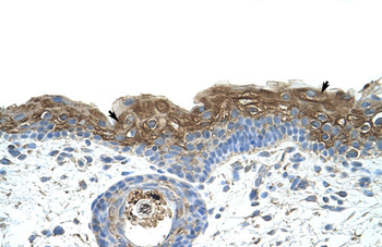 EIF2A Rabbit Polyclonal Antibody