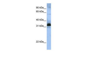 SFRS2B Rabbit Polyclonal Antibody