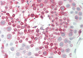 BRD9 Rabbit Polyclonal Antibody