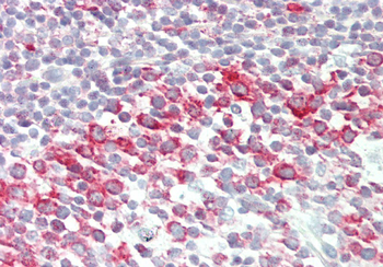 BRD9 Rabbit Polyclonal Antibody