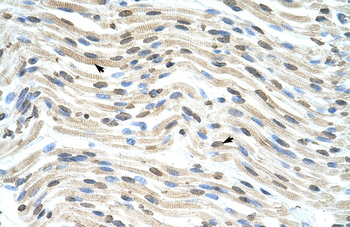 THOC3 Rabbit Polyclonal Antibody