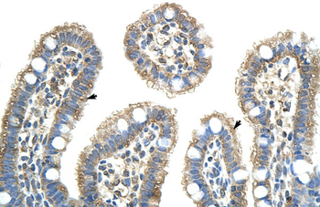 NXF5 Rabbit Polyclonal Antibody