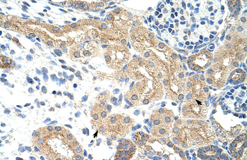 NXF5 Rabbit Polyclonal Antibody