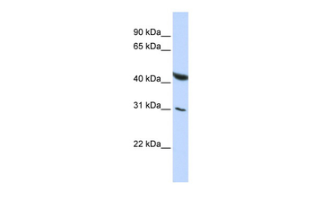 BRUNOL6 Rabbit Polyclonal Antibody