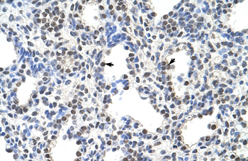 SRSF10 Rabbit Polyclonal Antibody