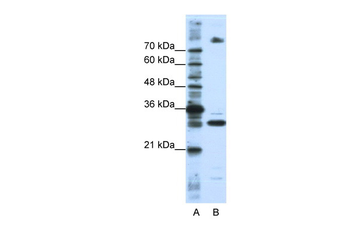 SRSF10 Rabbit Polyclonal Antibody