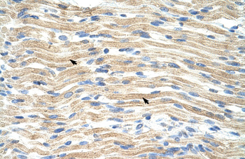 EXOSC6 Rabbit Polyclonal Antibody