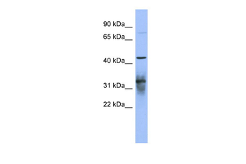 PABPC5 Rabbit Polyclonal Antibody