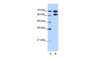 RAVER1 Rabbit Polyclonal Antibody