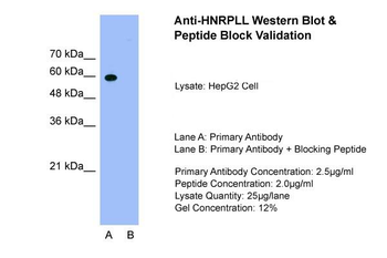 HNRPLL Rabbit Polyclonal Antibody
