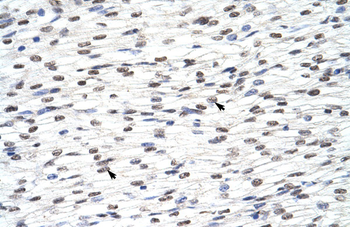 HNRPLL Rabbit Polyclonal Antibody