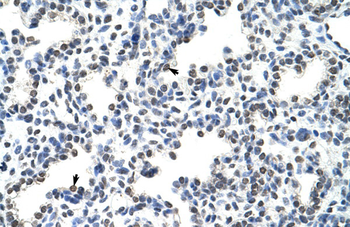 HNRPLL Rabbit Polyclonal Antibody