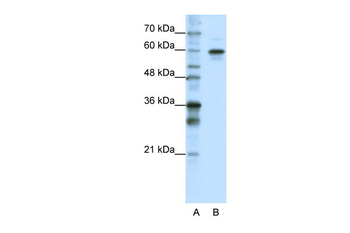 HNRPLL Rabbit Polyclonal Antibody