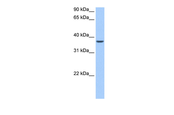 ALKBH8 Rabbit Polyclonal Antibody