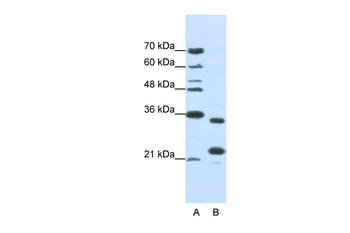 ALKBH8 Rabbit Polyclonal Antibody