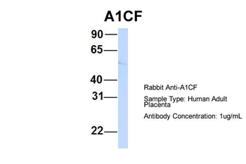 A1CF Rabbit Polyclonal Antibody